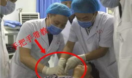 小针刀操作视频,精准施术，轻松掌握微创治疗技巧